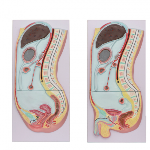 腹膜矢状切面模型